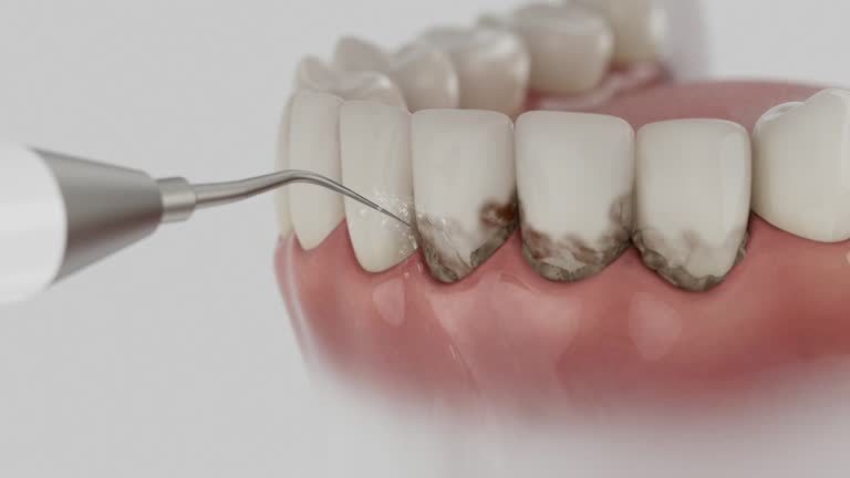 Reliable Dental Implants contractor in Webberville, MI by Smile Center Dentistry